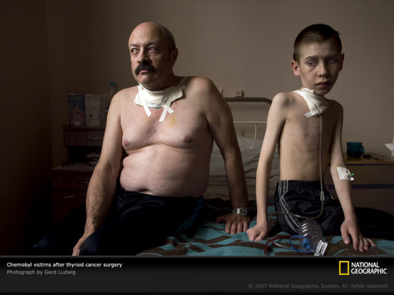 chernobyl cancerous 999805 sw